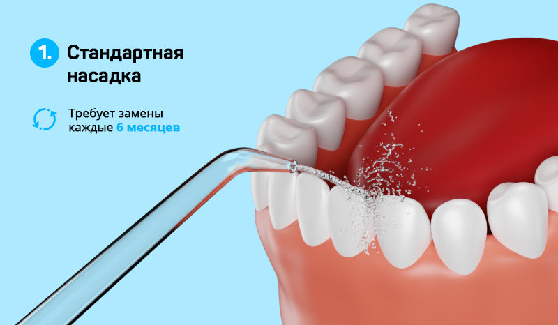 Имплант насадка. Ирригатор и импланты. Ирригатор для имплантов и коронок лучшие. Ирригатор при коронках.